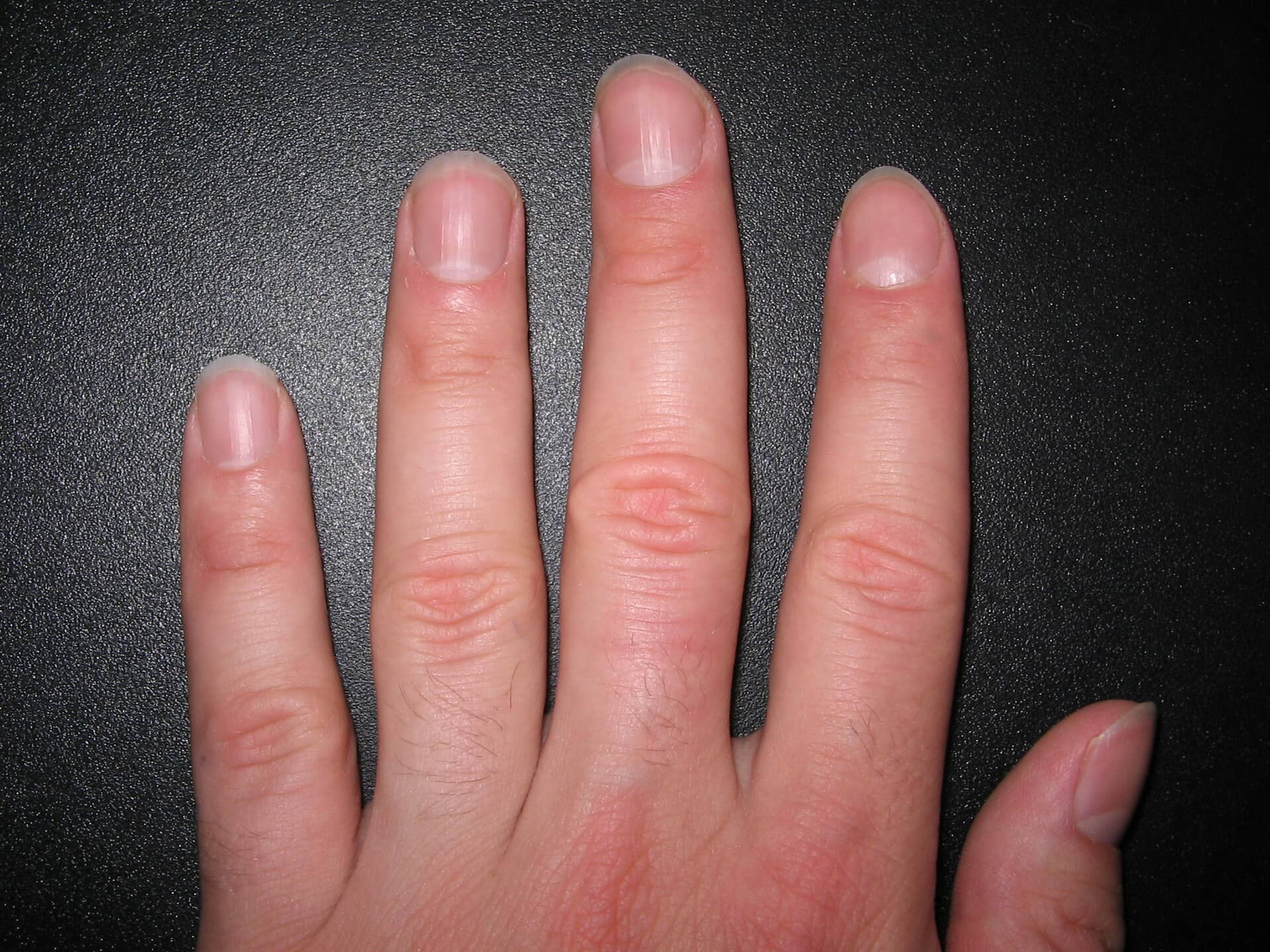 Cuidado com cutícula e unhas