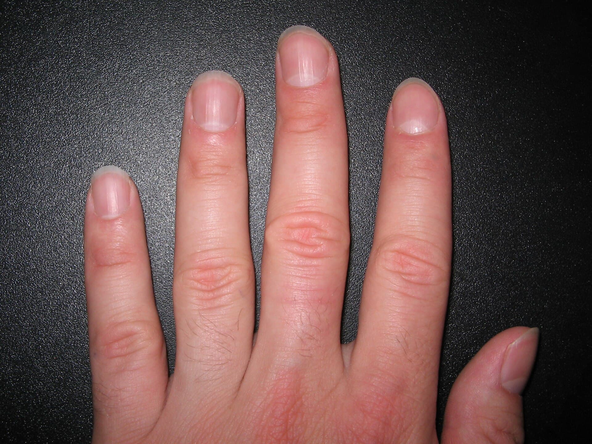 Cuidado com cutícula e unhas